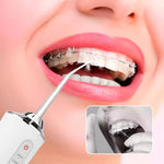 Irrigador Oral Eléctrico ® + Envío Gratis