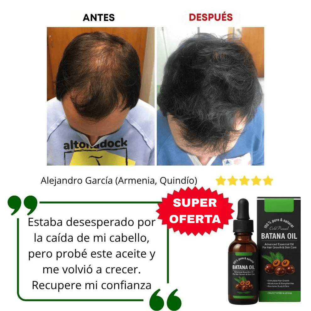 Aceite de Batana | El Secreto para Prevenir la caída del cabello y Estimular el Crecimiento