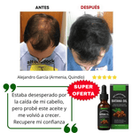 Aceite de Batana | El Secreto para Prevenir la caída del cabello y Estimular el Crecimiento