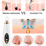 ✨ PoreClean® Pro — Adiós puntos negros y espinillas visibles en minutos