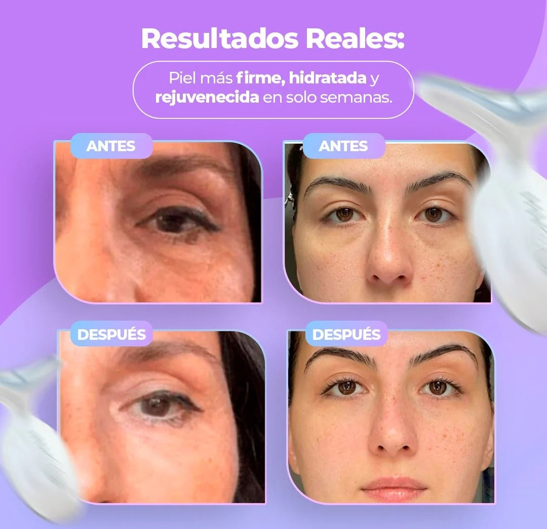 ¡OFERTA DE LANZAMIENTO! 🤩 Masajeador Facial - Terapia de Luz Facial Antienvejecimiento 7 en 1