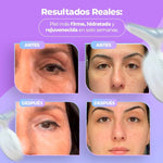 ¡OFERTA DE LANZAMIENTO! 🤩 Masajeador Facial - Terapia de Luz Facial Antienvejecimiento 7 en 1